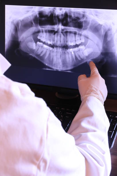 Best Emergency Root Canal Treatment in Murraysville, NC