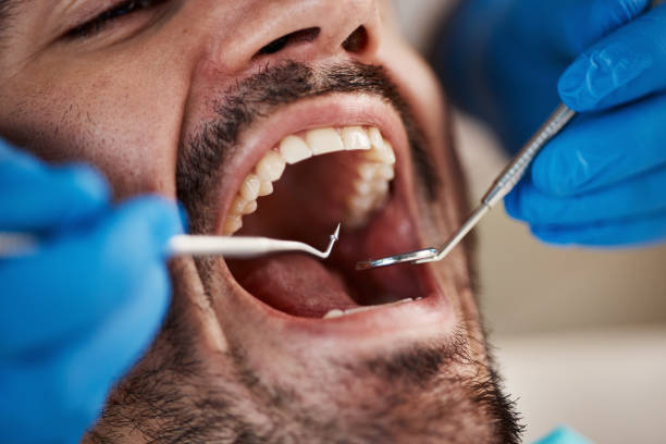 Best Emergency Root Canal Treatment in Murraysville, NC